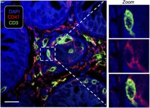 CD47 protects alloreactive T cells in GvHD, which can be therapeutically exploited, Heiko Bruns Erlangen University Hospital, Andreas Beilhack Würzburg University Hospital, TRR221 GvH-GvL Immunotherapy program, Germany